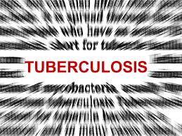 Strategi DOTS Tekan Penyebaran TB